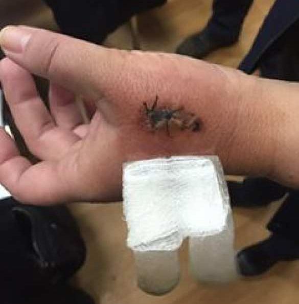 Продавец, избившая вдову карателя, рассказала подробности драки: "Назвала меня курвой и вцепилась ногтями в лицо" Продавец, избившая вдову карателя, рассказала подробности драки: "Назвала меня курвой и вцепилась ногтями в лицо"