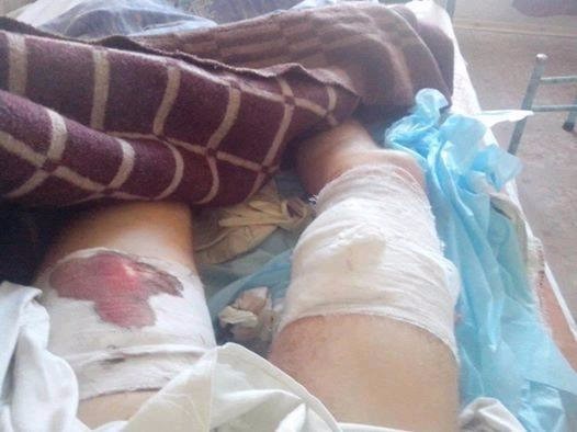 "Сафари на сепаров": бандеровцы приветствуют покушение на жизнь левого активиста и анонсируют новые расправы с неугодными "Сафари на сепаров": бандеровцы приветствуют покушение на жизнь левого активиста и анонсируют новые расправы с неугодными