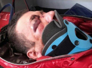 Пьяные американские солдаты жестоко избили поляка