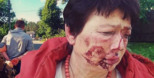 Европейские будни: Под Киевом избили главу избиркома – разборки за землю