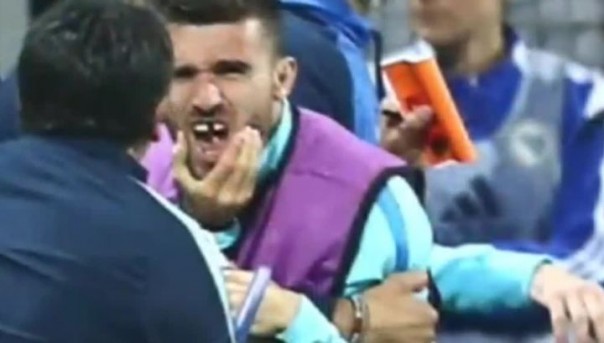 Отборочный матч ЧМ-2018 завершился массовой дракой и выбитыми зубами