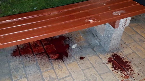 В центре Киева утилизировали хероя АТЫ начальника разведки 54-й ОМБР В центре Киева утилизировали хероя АТЫ начальника разведки 54-й ОМБР