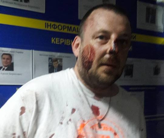 Киевская полиция задержала боевиков «АТО», устроивших провокации 18+ Киевская полиция задержала боевиков «АТО», устроивших провокации 18+