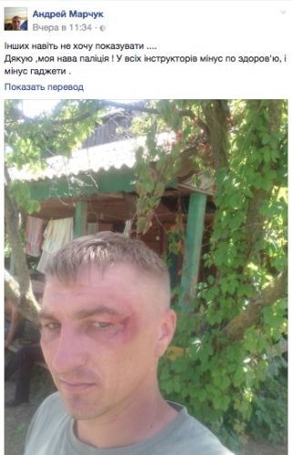 На Украине опять избили участников АТО На Украине опять избили участников АТО