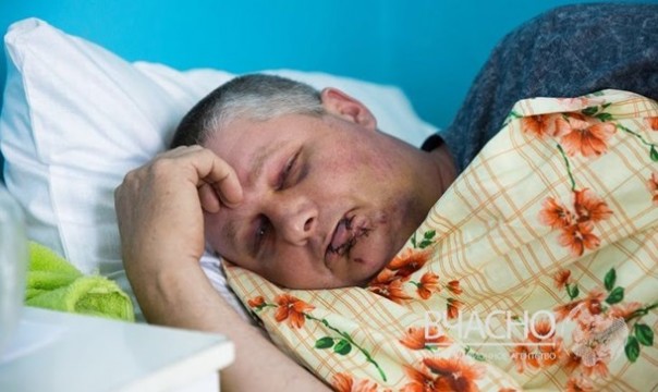 За выкрик «Слава Украине» «патриоту» разбили голову в оккупированной части Донбасса За выкрик «Слава Украине» «патриоту» разбили голову в оккупированной части Донбасса