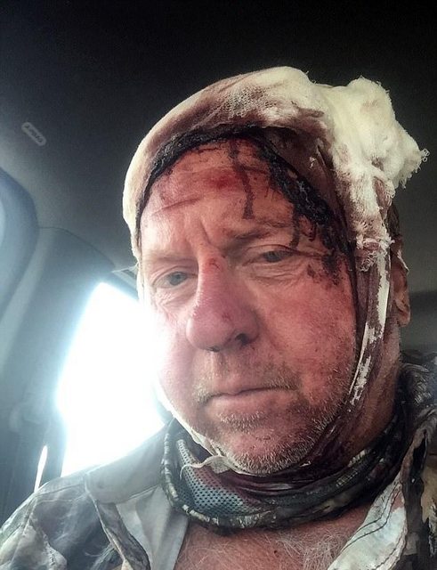 Охотник, которого вырвали из лап гризли: Я слышал хруст собственных костей