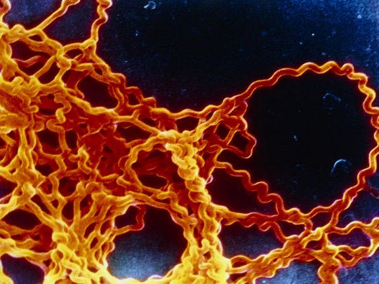 Чистая и полезная вода: Во Львове мужчина искупался в озере и скончался от лептоспироза