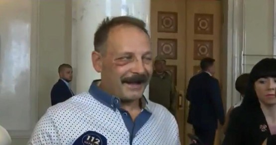 Бубеноносец Яйценюка Барна в очередной раз получил в табло