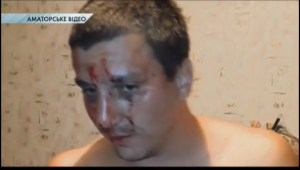 В Чернигове нацисты из С-14 избили мужчину, назвавшего украинский язык "фашистским"