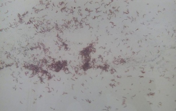 На Одесчине из кранов потекла вода с червями