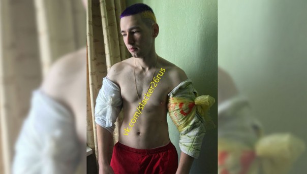 "Хана базукам": Кирилл Терешин лишился огромных рук