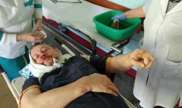 На Полтавщине переломали руки соратнику Саакашвили