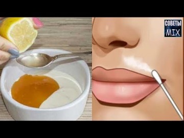 Как навсегда избавиться от женских усиков в домашних условиях. Рецепт здоровья молодости и красоты