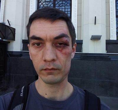 В Одессе нацисты избили молодого человека