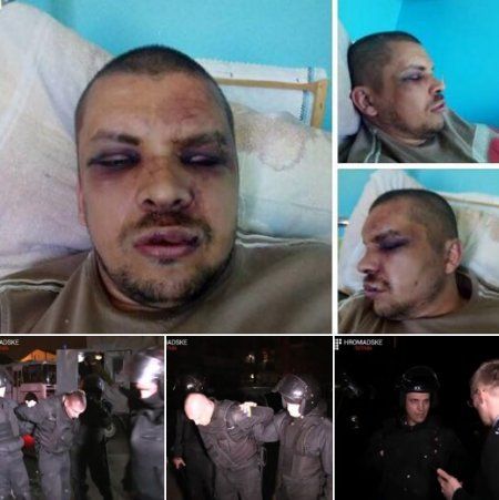 Жителю Кременчуга за георгиевскую ленту сломали нос и выбили 10 зубов