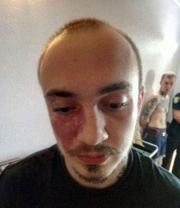 Украинские СМИ трубят о задержании антифашистов, напавших в Киеве на основателя С14