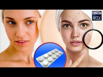 Маска для лица на основе аспирина. Очень эффективно и дешево. Рецепт здоровья