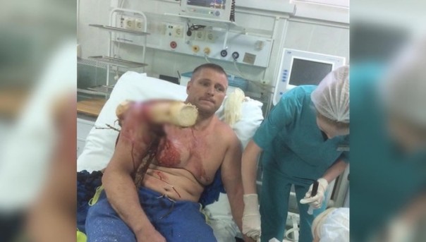 "Я есть Грут": пронзенный бревном парапланерист снова рвется в бой