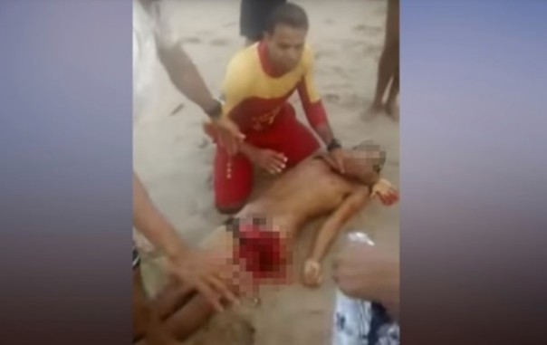 В Бразилии купающемуся 15-летнему подростку акула откусила половые органы