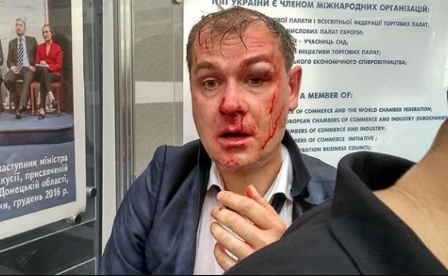 Радикалы избили в Киеве замглавы партии «Умная сила»