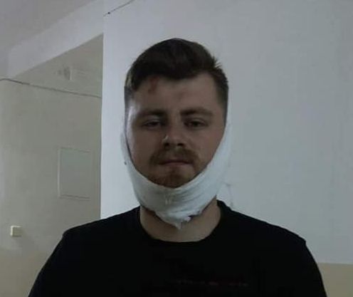 Сало уронили! Хрюмбергу сломали челюсть за выкрик "Слава Украине"