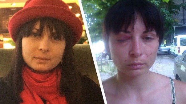 Суд на Украине рассматривает жуткое дело о пытках СБУ