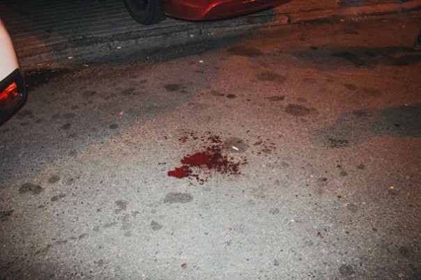 В Киеве возле ботсада произошла стрельба, есть пострадавшие