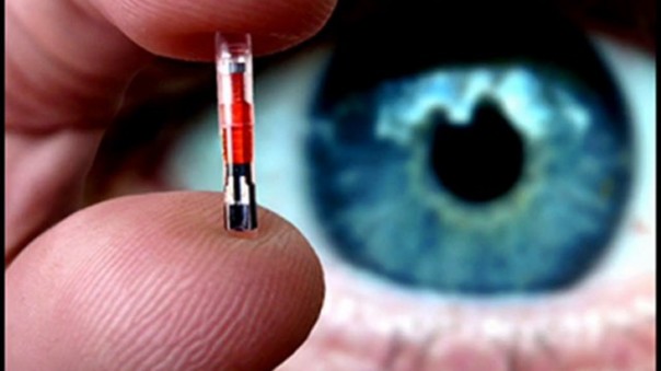 Вот и доказательство существования пришельцев на Земле! Обнаружен инопланетный чип в человеке