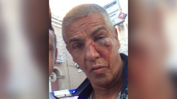 "Начали буянить". Обидчик Сами Насери рассказал, за что избил актёра