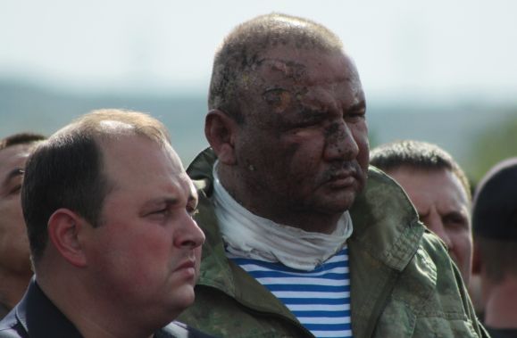 Министра доходов ДНР Александра Тимофеева выписали из больницы после взрыва в кафе