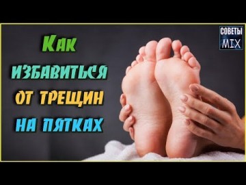 Супер средство, которое избавит от трещин и мозолей на пятках всего за 10 дней. Рецепты здоровья