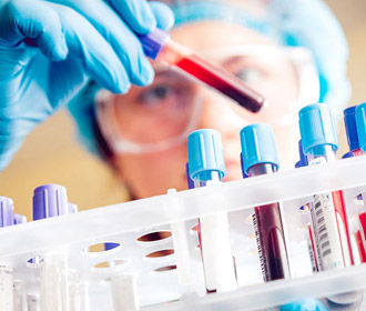 В Одесской области 5 человек заболели сибирской язвой