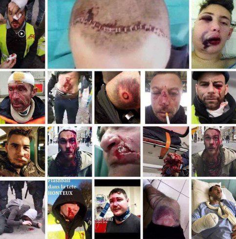 Альбац и Тютюкин хотят "як у Парыжи"