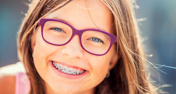 Аномалии зубного ряда: в чем причины? Способы лечения