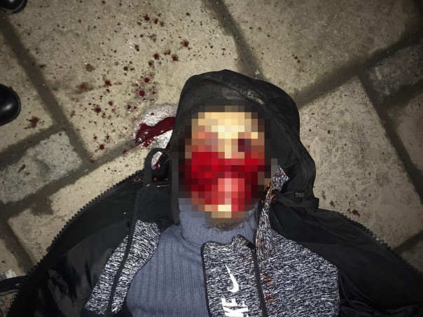 В Нальчике совершено нападение на экипаж ДПС