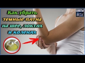 Супер средство для отбеливания кожи на коленях, подмышках, коленях и локтях народными средствами