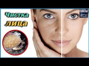 Супер маска для лица от черных точек. Всего через несколько минут лицо выглядит как в журнале. +Рецепт