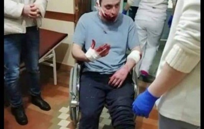 Под Киевом стреляли в посетителя магазина [18+] 