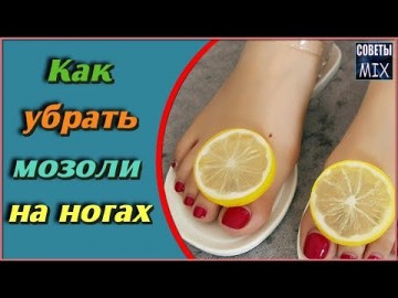 Вот как просто избавиться от мозолей на ногах народными средствами в домашних условиях. Рецепты здоровья