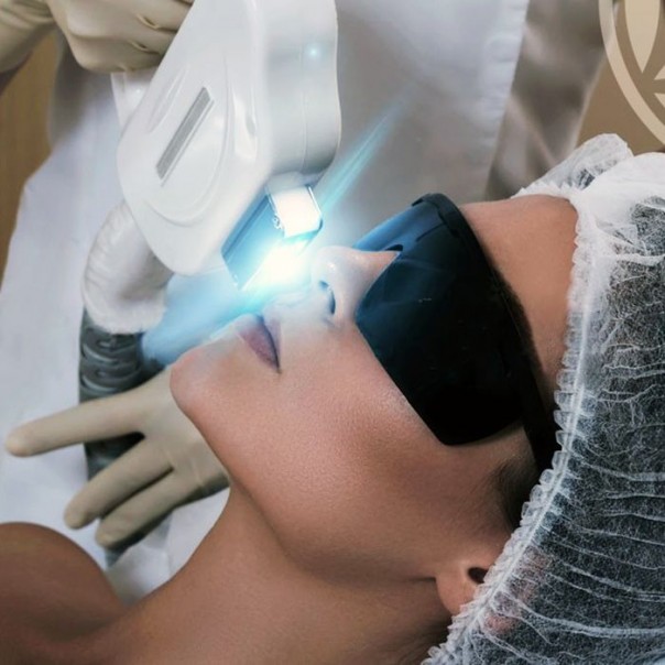 Лазерная эпиляция: особенности и преимущества
