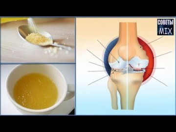 Вот почему у меня не болят суставы: Уникальный рецепт домашнего средства. Секрет здоровья и долголетия