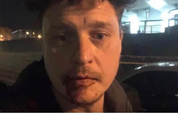 Кричали, что любят "рашку": в центре Киева избили автора фильмов о Майдане