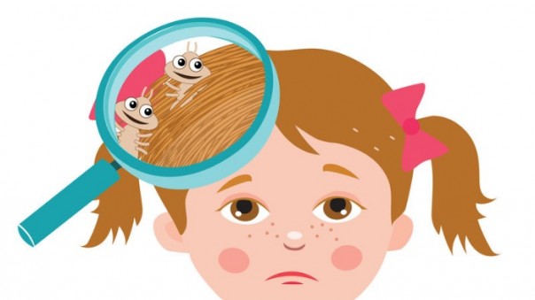 симптомы появления вшей