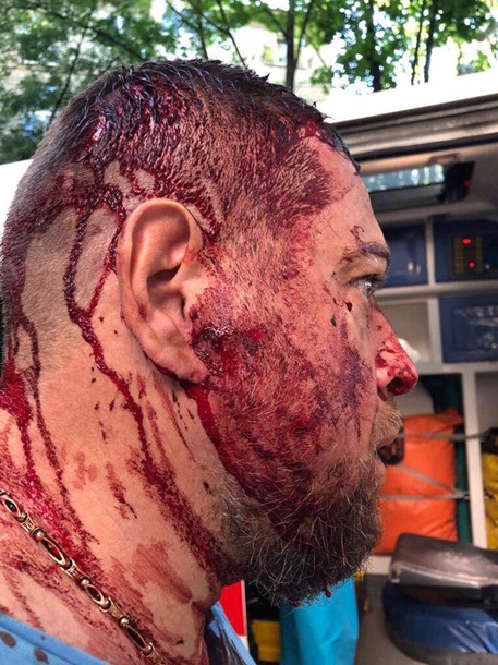 В Харькове избили укроозабоченного из Нацкорпуса