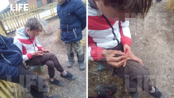 На Урале подростки заставили сверстника соскребать татуировку гвоздём