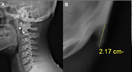 Как современная жизнь трансформирует ваше тело
