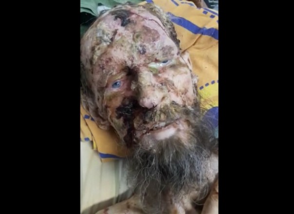 В Туве мужчина со сломанным позвоночником месяц жил в берлоге медведя