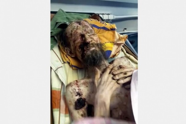 [18+] «Живая мумия из берлоги»: что удалось узнать к этому моменту