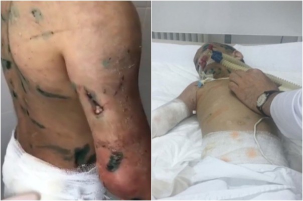 Били. Издевались. Тушили окурки об семилетнюю девочку