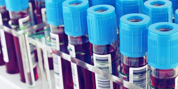 Медики научились диагностировать посттравматическое расстройство по составу крови